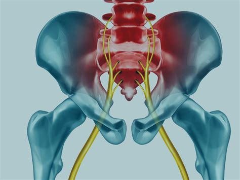 sciatic compression test|does compression help with sciatica.